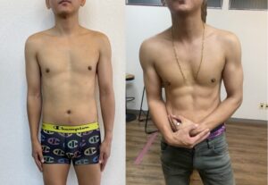 40代男性ビフォーアフター